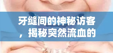 牙縫間的神秘訪客，揭秘突然流血的真相