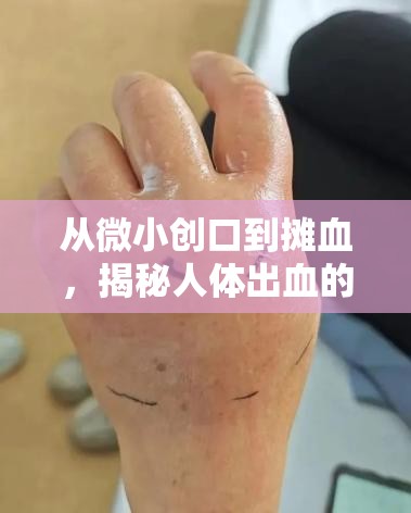 從微小創(chuàng)口到攤血，揭秘人體出血的驚人時(shí)間之旅