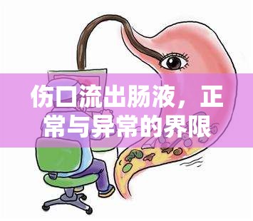 傷口流出腸液，正常與異常的界限——身體自我保護(hù)與異常信號的解析