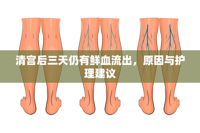 清宮后三天仍有鮮血流出，原因與護理建議