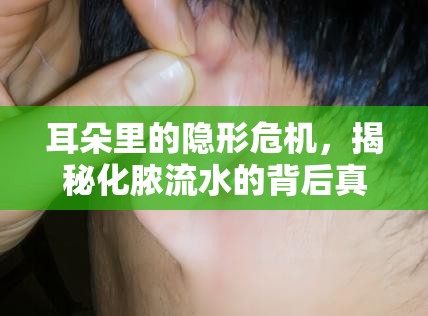 耳朵里的隱形危機(jī)，揭秘化膿流水的背后真相