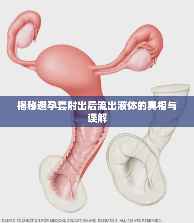 揭秘避孕套射出后流出液體的真相與誤解
