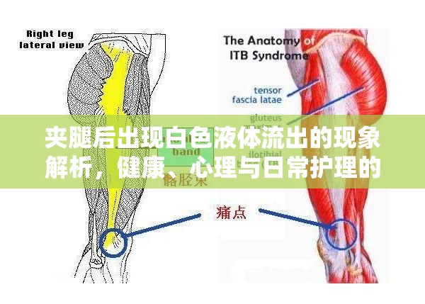 夾腿后出現(xiàn)白色液體流出的現(xiàn)象解析，健康、心理與日常護(hù)理的全面指南