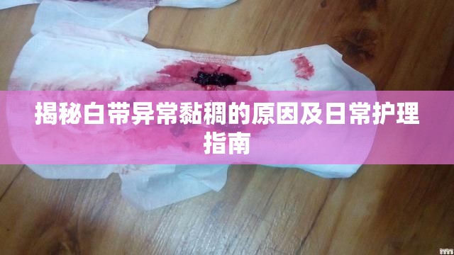 揭秘白帶異常黏稠的原因及日常護(hù)理指南