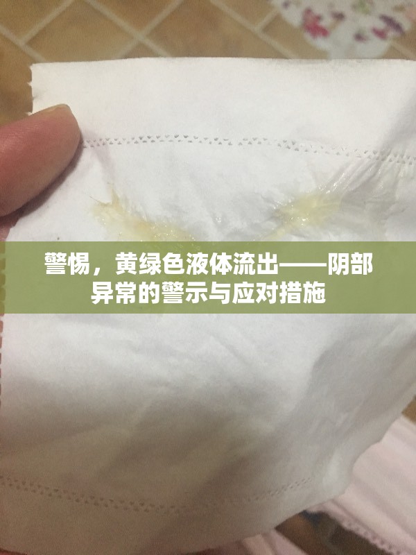 警惕，黃綠色液體流出——陰部異常的警示與應(yīng)對(duì)措施