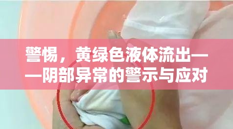 警惕，黃綠色液體流出——陰部異常的警示與應(yīng)對(duì)措施