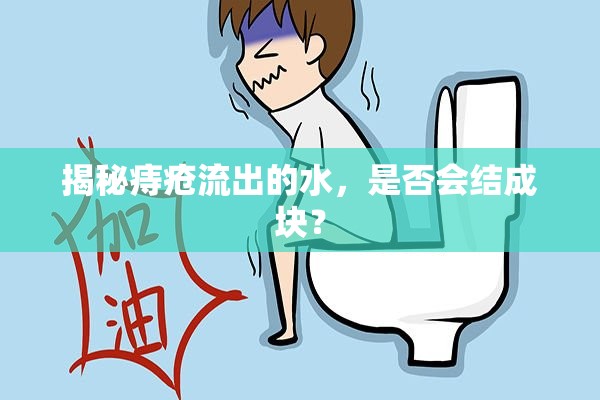 揭秘痔瘡流出的水，是否會(huì)結(jié)成塊？