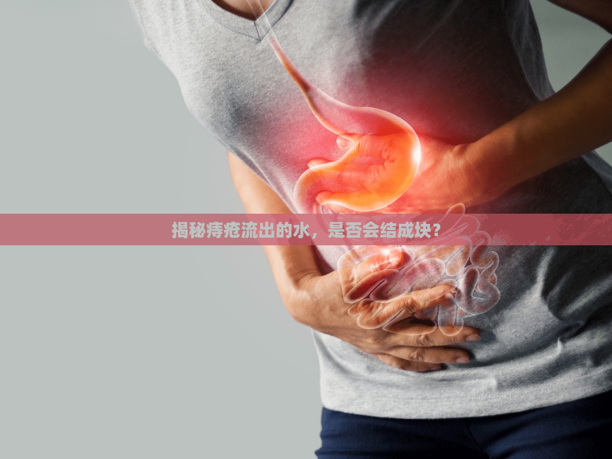 揭秘痔瘡流出的水，是否會(huì)結(jié)成塊？