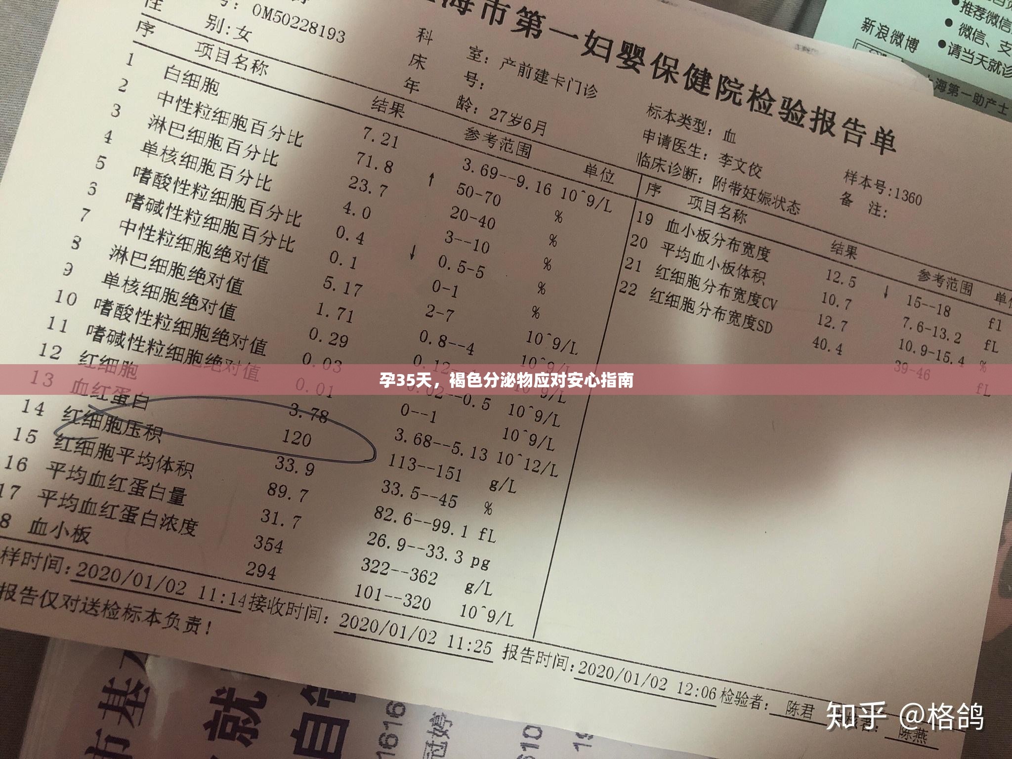 孕35天，褐色分泌物應(yīng)對安心指南