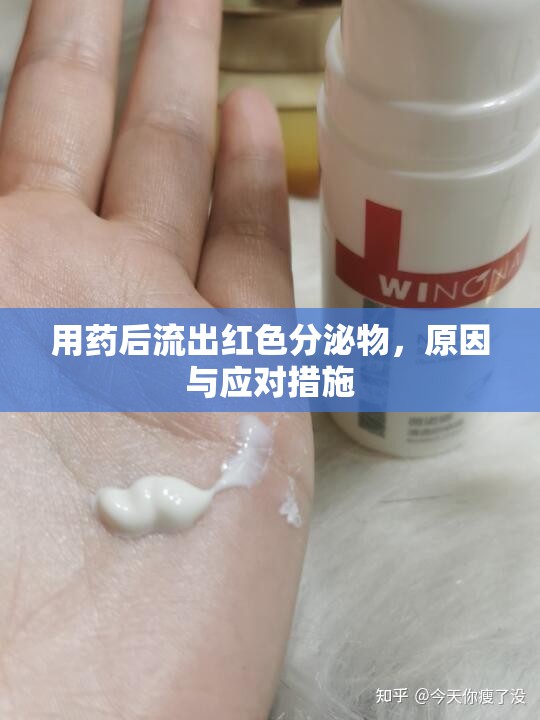 用藥后流出紅色分泌物，原因與應(yīng)對(duì)措施