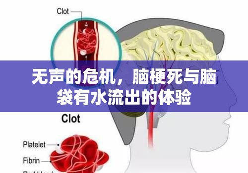 無(wú)聲的危機(jī)，腦梗死與腦袋有水流出的體驗(yàn)