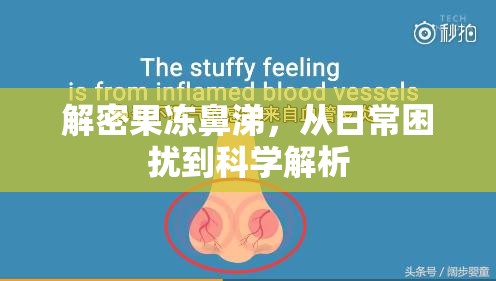 解密果凍鼻涕，從日常困擾到科學(xué)解析