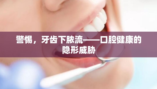 警惕，牙齒下膿流——口腔健康的隱形威脅
