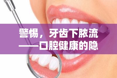 警惕，牙齒下膿流——口腔健康的隱形威脅
