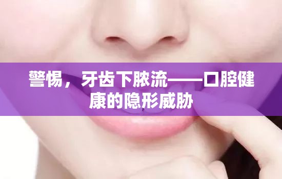 警惕，牙齒下膿流——口腔健康的隱形威脅