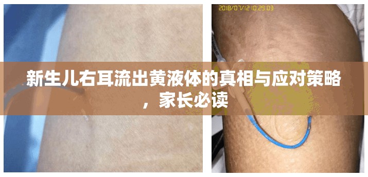 新生兒右耳流出黃液體的真相與應(yīng)對策略，家長必讀