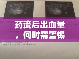 藥流后出血量，何時需警惕大出血的信號？
