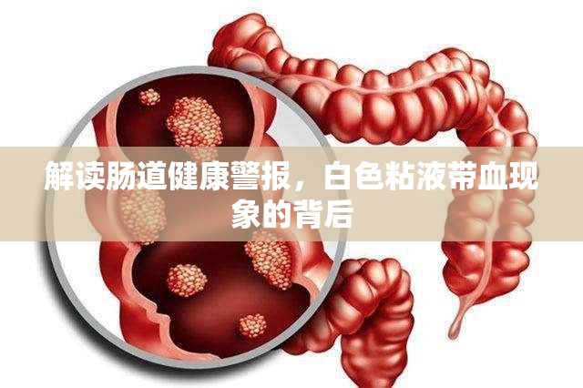 解讀腸道健康警報(bào)，白色粘液帶血現(xiàn)象的背后