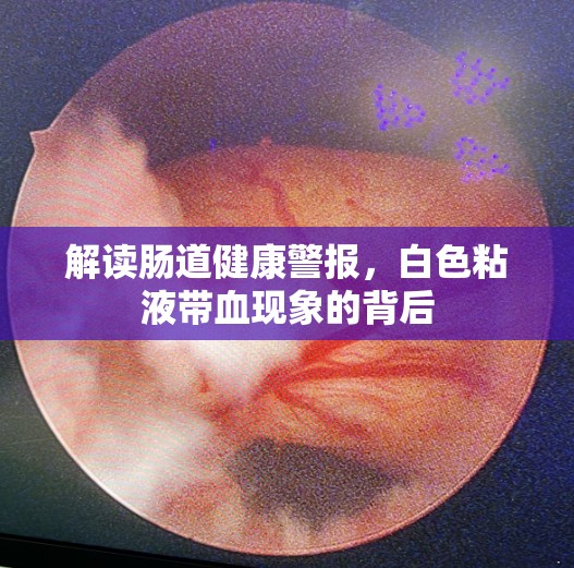 解讀腸道健康警報(bào)，白色粘液帶血現(xiàn)象的背后