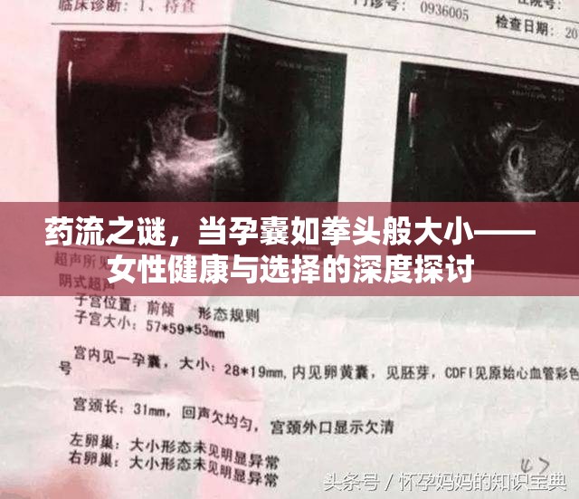 藥流之謎，當(dāng)孕囊如拳頭般大小——女性健康與選擇的深度探討