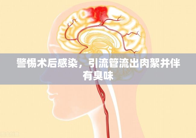 警惕術(shù)后感染，引流管流出肉絮并伴有臭味