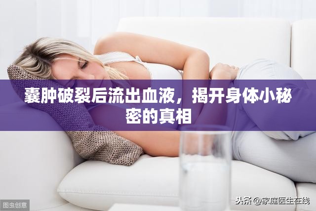 囊腫破裂后流出血液，揭開身體小秘密的真相