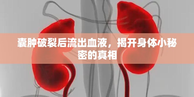 囊腫破裂后流出血液，揭開身體小秘密的真相