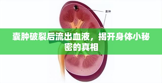 囊腫破裂后流出血液，揭開身體小秘密的真相