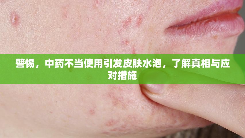警惕，中藥不當(dāng)使用引發(fā)皮膚水泡，了解真相與應(yīng)對措施