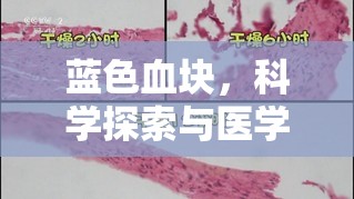 藍(lán)色血塊，科學(xué)探索與醫(yī)學(xué)解析