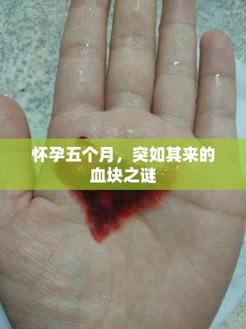 懷孕五個月，突如其來的血塊之謎