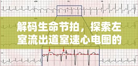 解碼生命節(jié)拍，探索左室流出道室速心電圖的奧秘