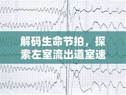 解碼生命節(jié)拍，探索左室流出道室速心電圖的奧秘