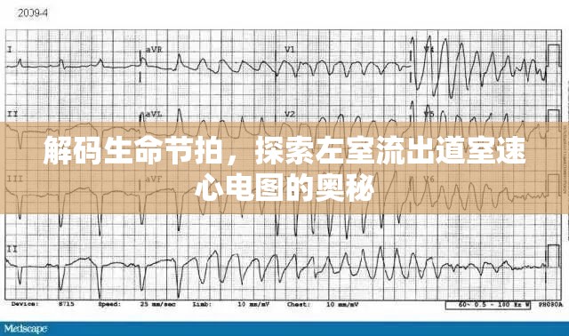 解碼生命節(jié)拍，探索左室流出道室速心電圖的奧秘