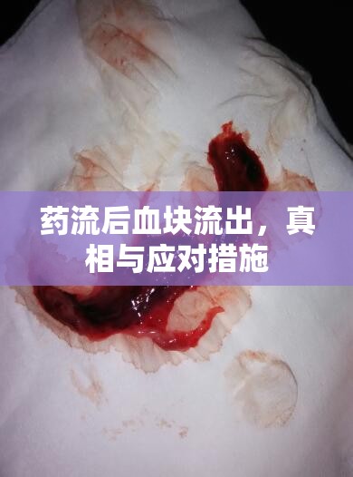 藥流后血塊流出，真相與應對措施