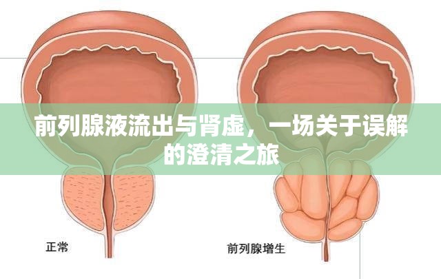 前列腺液流出與腎虛，一場(chǎng)關(guān)于誤解的澄清之旅