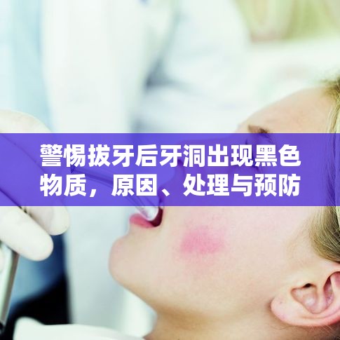 警惕拔牙后牙洞出現(xiàn)黑色物質(zhì)，原因、處理與預(yù)防措施