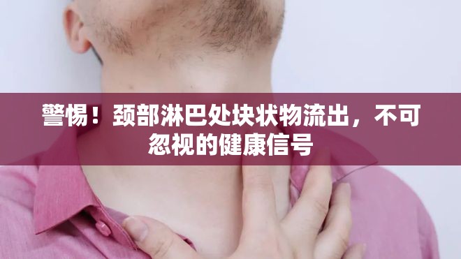 警惕！頸部淋巴處塊狀物流出，不可忽視的健康信號(hào)