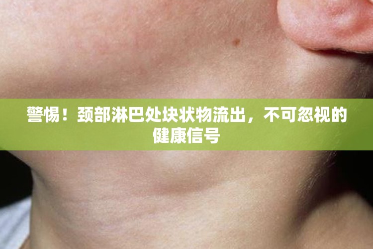 警惕！頸部淋巴處塊狀物流出，不可忽視的健康信號(hào)
