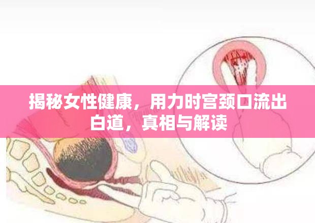 揭秘女性健康，用力時宮頸口流出白道，真相與解讀