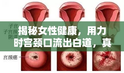 揭秘女性健康，用力時宮頸口流出白道，真相與解讀
