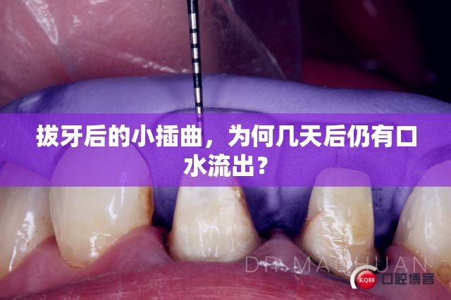 拔牙后的小插曲，為何幾天后仍有口水流出？