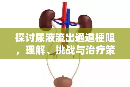 探討尿液流出通道梗阻，理解、挑戰(zhàn)與治療策略