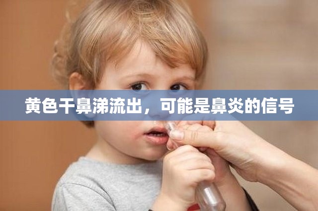 黃色干鼻涕流出，可能是鼻炎的信號(hào)
