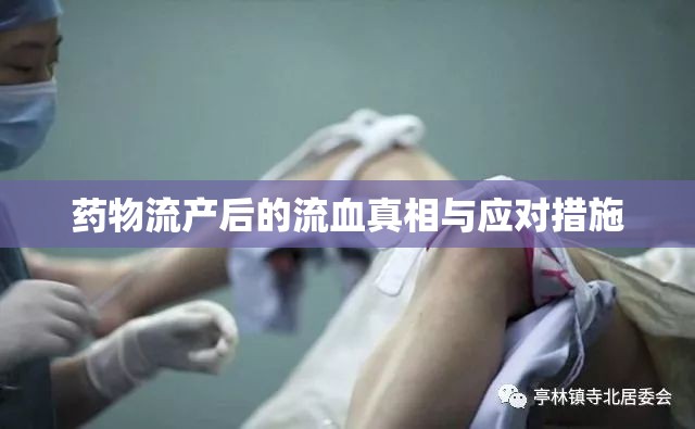 藥物流產(chǎn)后的流血真相與應(yīng)對(duì)措施
