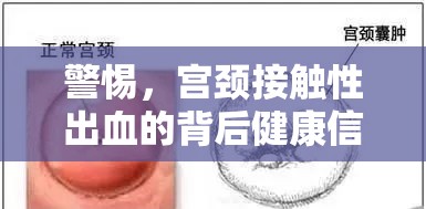 警惕，宮頸接觸性出血的背后健康信號與應對策略