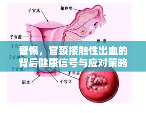 警惕，宮頸接觸性出血的背后健康信號與應對策略