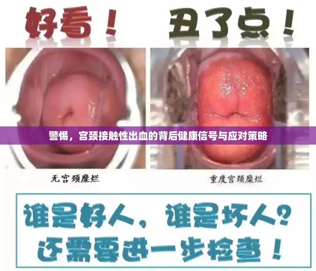 警惕，宮頸接觸性出血的背后健康信號與應對策略