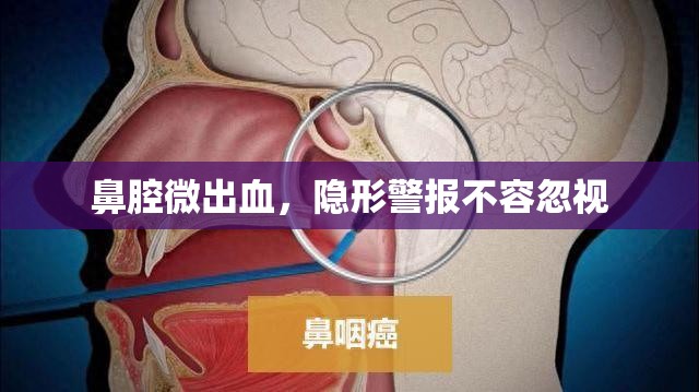鼻腔微出血，隱形警報不容忽視