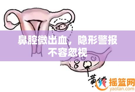 鼻腔微出血，隱形警報不容忽視